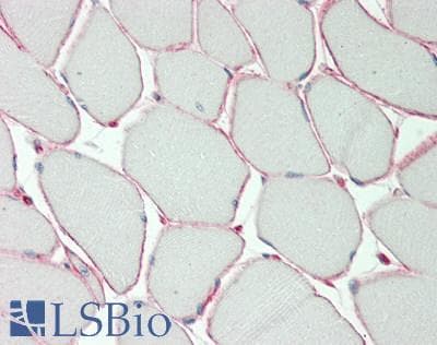 IHC-plus™ KCNE5 Antibody (aa67-96)