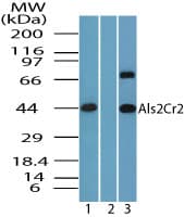 IHC-plus™ Polyclonal Rabbit anti-Human STRADB / ALS2CR2 Antibody (aa200-250, IHC, WB)