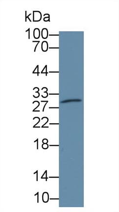 CA2 / Carbonic Anhydrase II Antibody