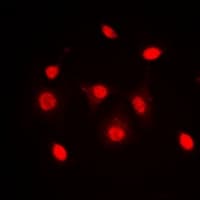 Polyclonal Rabbit anti-Human DKC1 / Dyskerin Antibody (Internal, IHC, IF, WB)