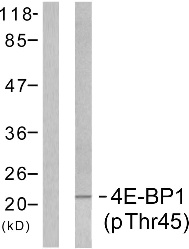 Polyclonal Rabbit anti-Human EIF4EBP1 / 4EBP1 Antibody (phospho-Thr45, IHC, WB)