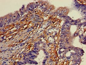 Polyclonal Rabbit anti-Human YIPF3 Antibody (IHC, IF, WB)