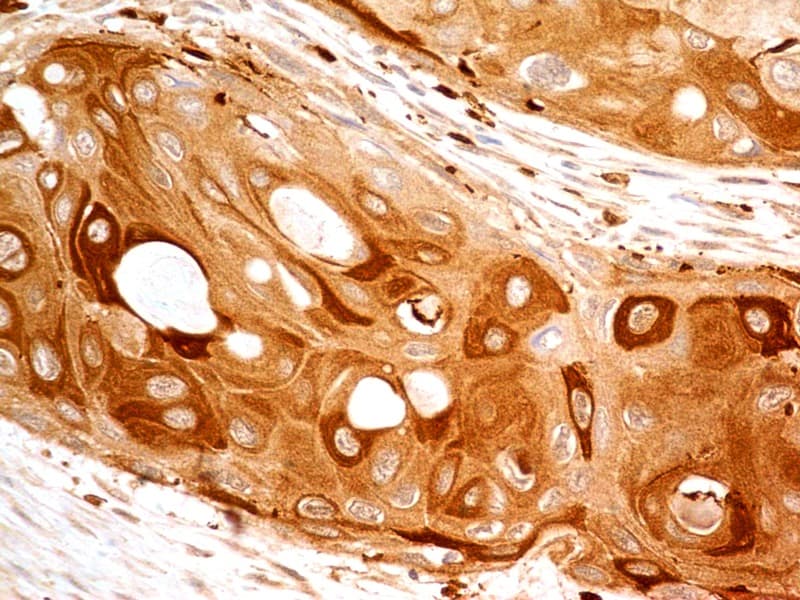 CASP8 / Caspase 8 Antibody