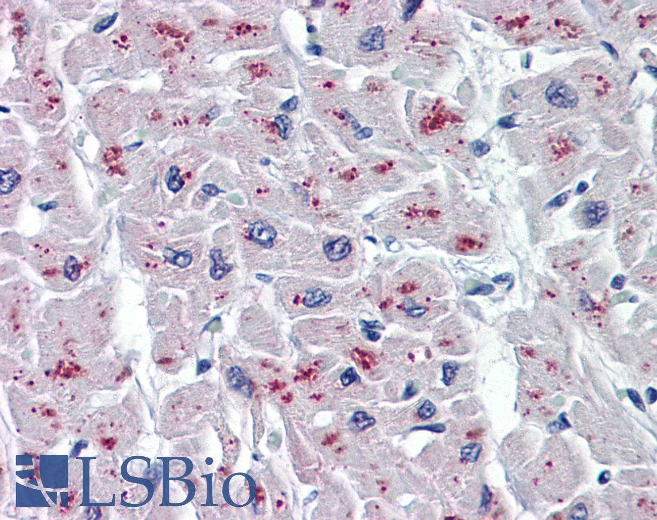 IHC-plus™ Monoclonal Mouse anti-Human ASAH1 / Acid Ceramidase Antibody (clone 1A7, IHC, WB)