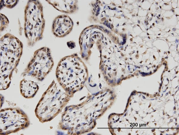 Monoclonal Mouse anti-Human PLEKHO1 / CKIP-1 Antibody (clone 1C7, IHC)