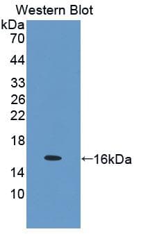 Procalcitonin Antibody (aa26-136, HRP)