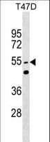 HnRNPLL / HNRPLL Antibody (aa132-162)