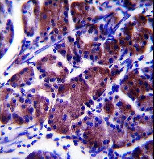 LYPLAL1 Antibody (aa88-117)