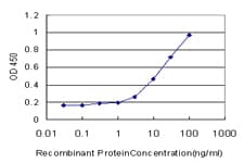 RPL32 / Ribosomal Protein L32 Antibody (clone 1C3)