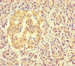 KDM4C / JMJD2C Antibody (aa450-600)