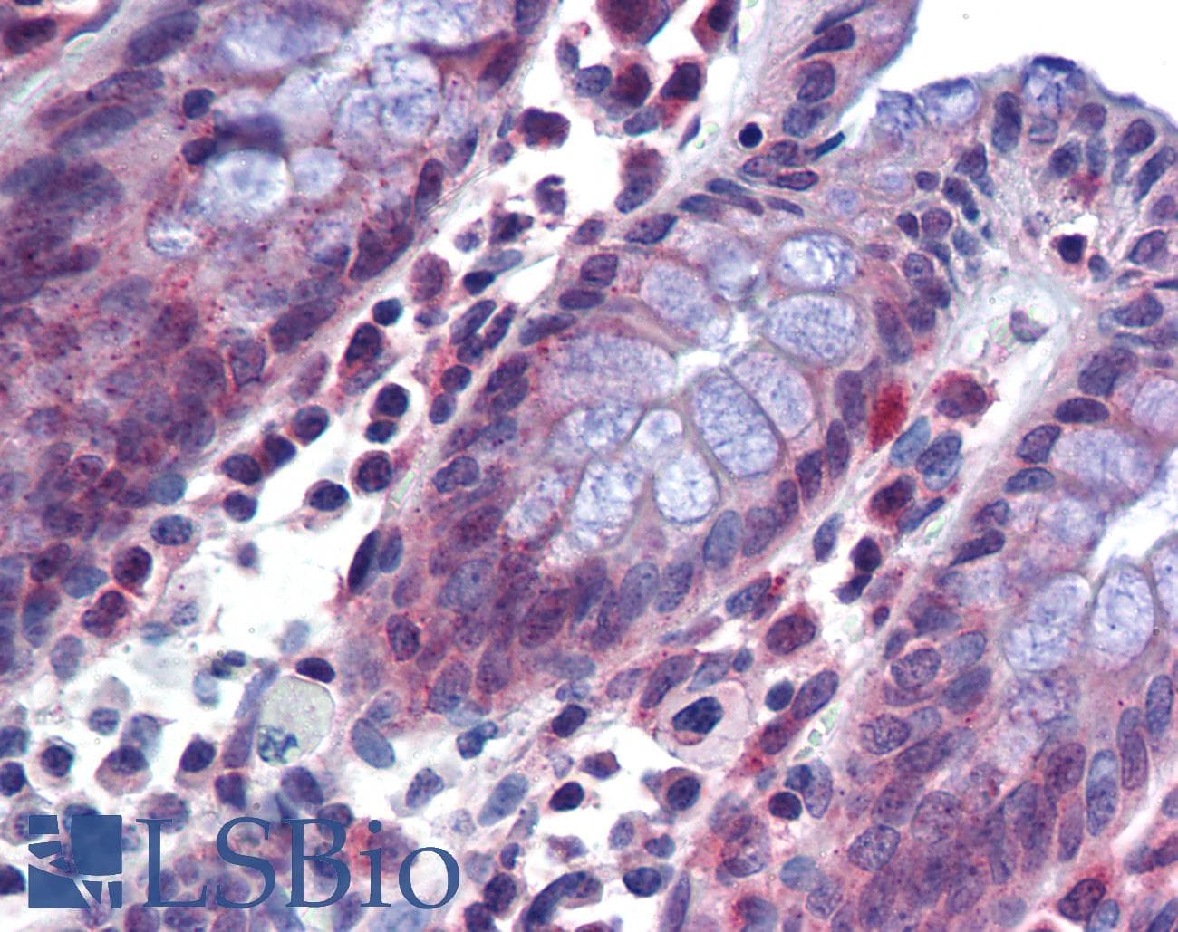 Polyclonal Rabbit anti-Human SRSF4 / SFRS4 Antibody (aa395-444, IHC, WB)