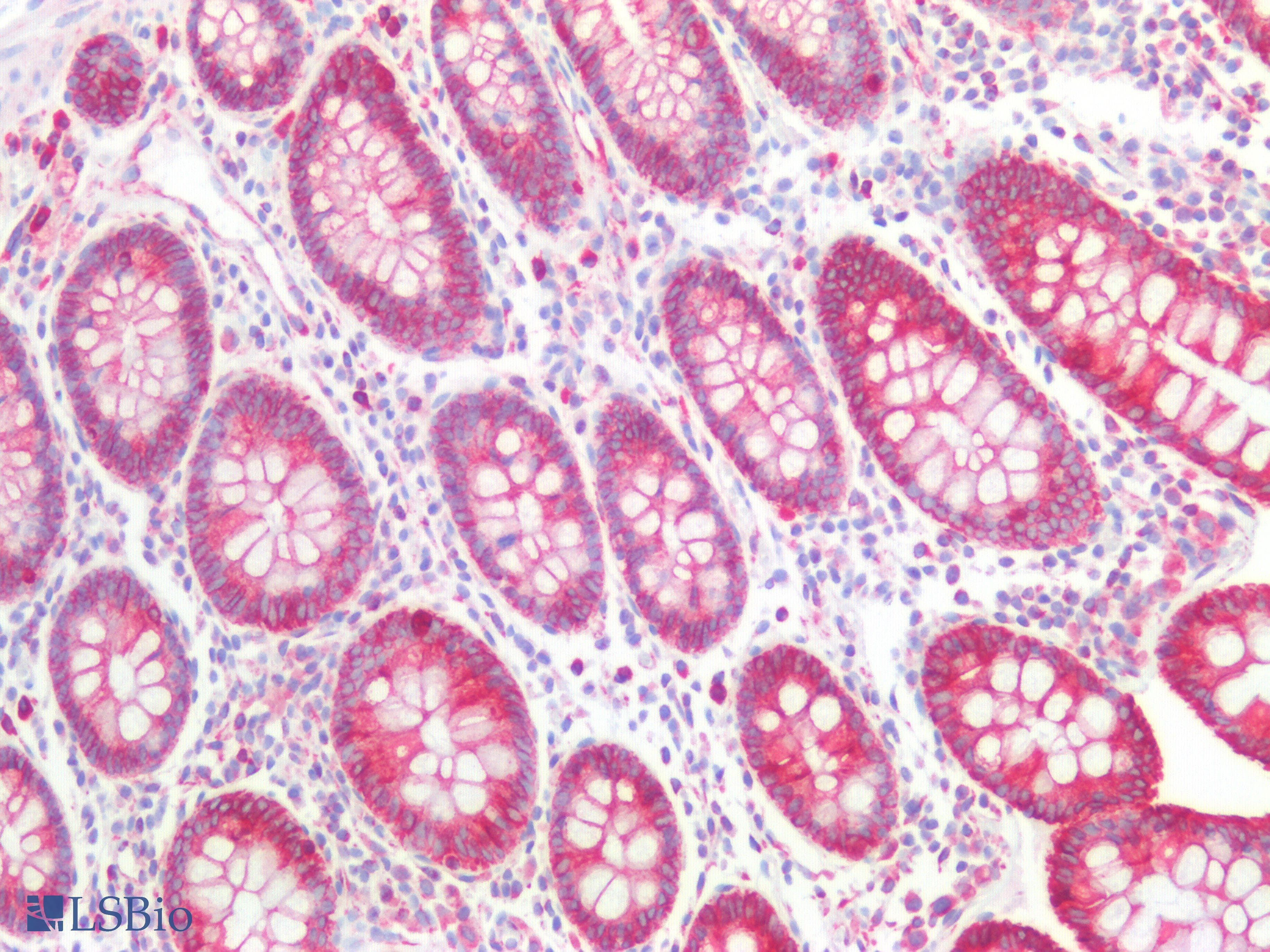IHC-plus™ KRT18 / CK18 / Cytokeratin 18 Antibody (C-Terminus)