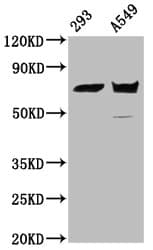 Polyclonal Rabbit anti-Human PLS1 / Fimbrin Antibody (IHC, IF, WB)