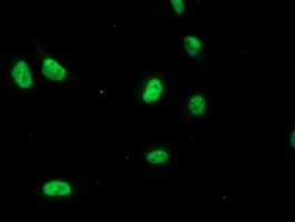 CDK2 Antibody (clone OTI1A8)