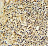 Polyclonal Rabbit anti-Human FKBP11 Antibody (aa159-188, IHC, WB)