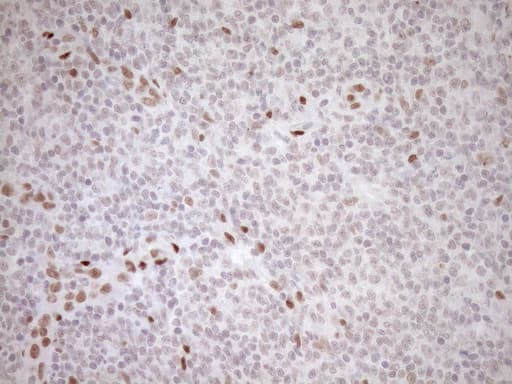 NR1H3 / LXR Alpha Antibody (aa69-329, clone OTI1A5)