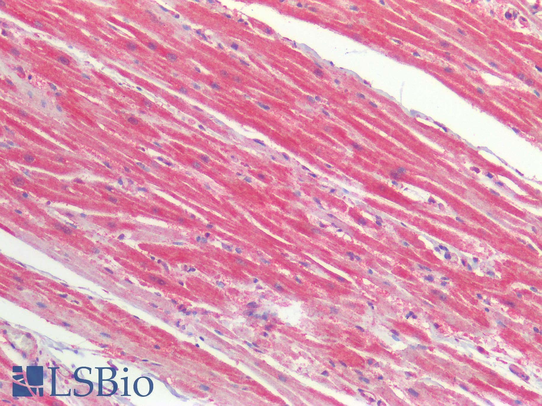PathPlus™ PRDX3 / Peroxiredoxin 3 Antibody (aa206-256)