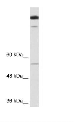 TIMELESS Antibody (aa290-339)