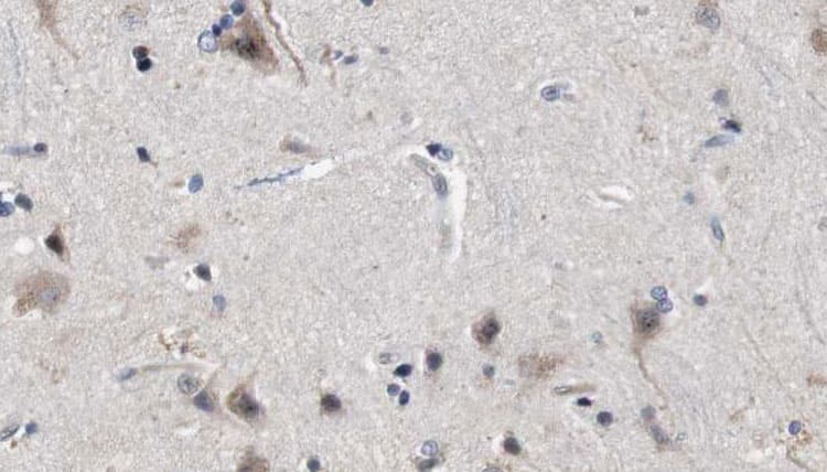 MFF Antibody