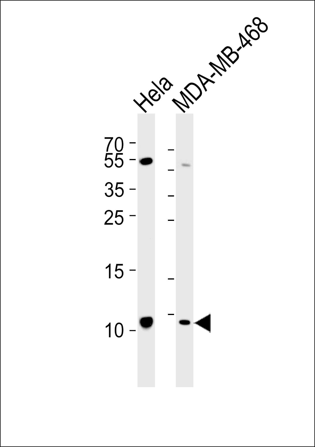 SNRPG Antibody (aa2-36)