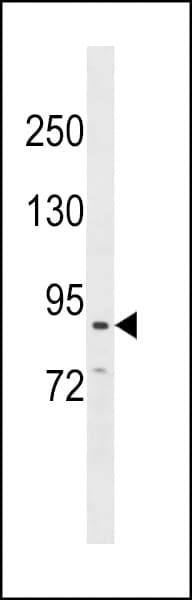 CDH26 / Cadherin 26 Antibody (aa818-846)