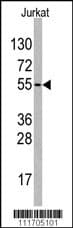 Polyclonal Rabbit anti-Human VEGFA / VEGF Antibody (IHC, WB)
