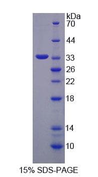 Human GANAB / Alpha Glucosidase II Protein (Recombinant His-T7, N-terminus)