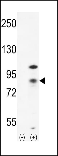 CTNNB1 / Beta Catenin Antibody (aa646-673)