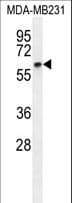 CCNB1 / Cyclin B1 Antibody (aa381-411)