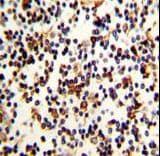 CR2 / CD21 Antibody (aa986-1014)