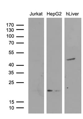 AMDHD1 Antibody (clone OTI5B5)