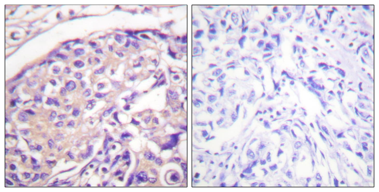 Polyclonal Rabbit anti-Human Tuberin / TSC2 Antibody (phospho-Thr1462, IHC)