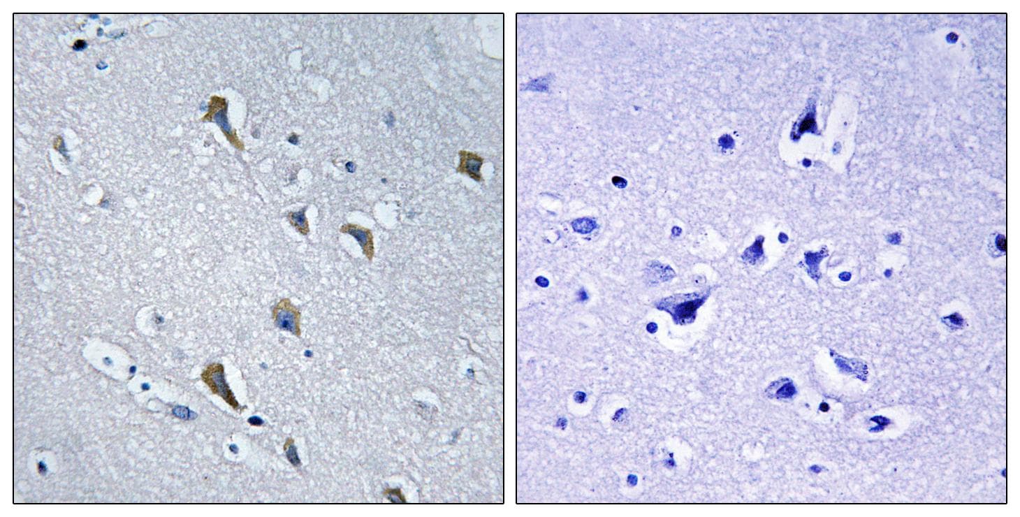 MRPS2 Antibody