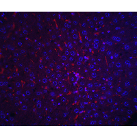 Polyclonal Rabbit anti-Human Alpha-Fetoprotein Antibody (IHC, IF, WB)