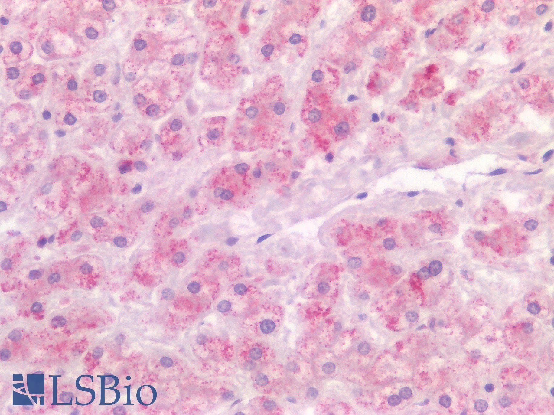 IHC-plus™ CD4 Antibody (Extracellular Domain)