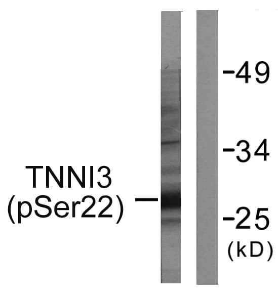 Polyclonal Rabbit anti-Mouse TNNI3 / Cardiac Troponin I Antibody (phospho-Ser22/Ser23, IHC, WB)