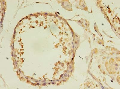 Polyclonal Rabbit anti-Human KIAA1257 Antibody (IHC)