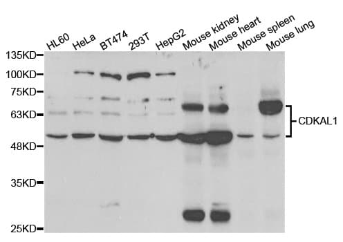 CDKAL1 Antibody