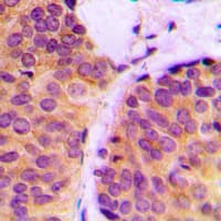 Polyclonal Rabbit anti-Human MLANA / Melan-A Antibody (Internal, IHC, WB)