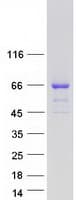 Human TKTL2 Protein (Recombinant Myc-DDK (Flag))