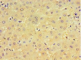 CRD / CRX Antibody (aa120-285)
