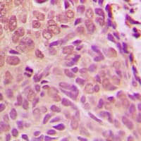 SMAD1 Antibody (N-Terminus)
