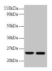 IHC-plus™ RBP4 Antibody (aa 19-201)
