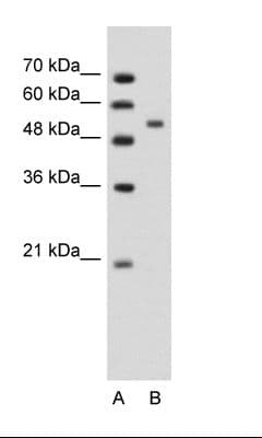 Polyclonal Rabbit anti-Human PLIN1 / Perilipin Antibody (aa81-130, WB)