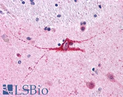 PathPlus™ ADORA1 / Adenosine A1 Receptor Antibody (Cytoplasmic Domain)
