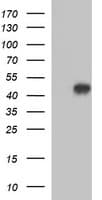 ACAA2 Antibody (clone OTI3H9)