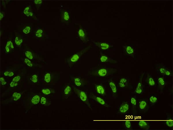 AKAP8 / AKAP95 Antibody (clone 3D4)