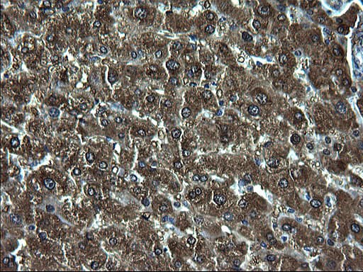 ZFAND3 / TEX27 Antibody (clone OTI1C5)