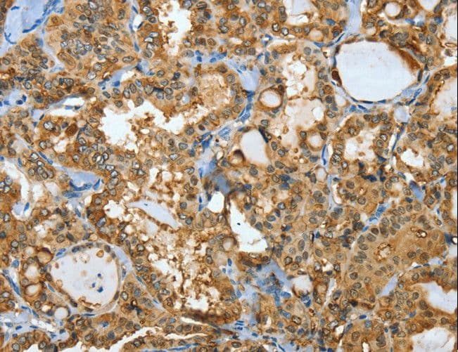 Polyclonal Rabbit anti-Human ANXA3 / Annexin A3 Antibody (IHC, WB)