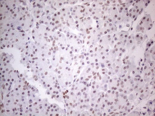 NR2C2 / TAK1 Antibody (aa1-241, clone OTI2H2)